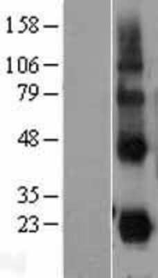 Western Blot: CD27 Ligand/TNFSF7/CD70 Overexpression Lysate [NBL1-08965]