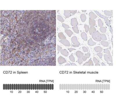 Immunohistochemistry-Paraffin: CD72 Antibody [NBP2-38533]