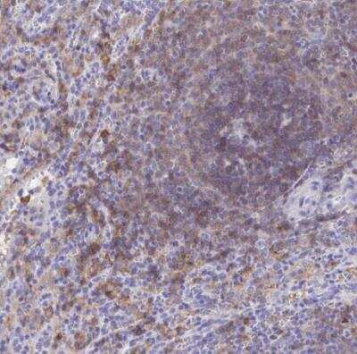 Immunohistochemistry-Paraffin: CD72 Antibody [NBP2-38533]