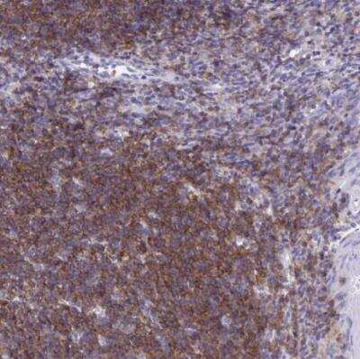 Immunohistochemistry-Paraffin: CD72 Antibody [NBP2-38533]