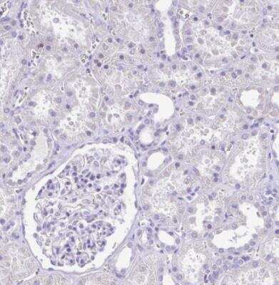 Immunohistochemistry-Paraffin: CD72 Antibody [NBP2-38533]
