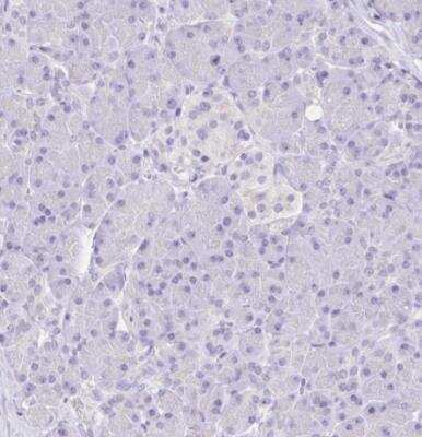 Immunohistochemistry-Paraffin: CD72 Antibody [NBP2-38533]