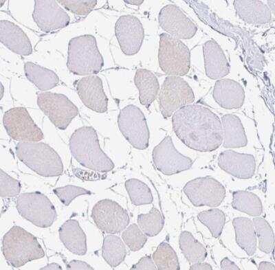 Immunohistochemistry-Paraffin: CD72 Antibody [NBP2-38533]