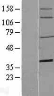 Western Blot: 5'-Nucleotidase/CD73 Overexpression Lysate [NBL1-13827]