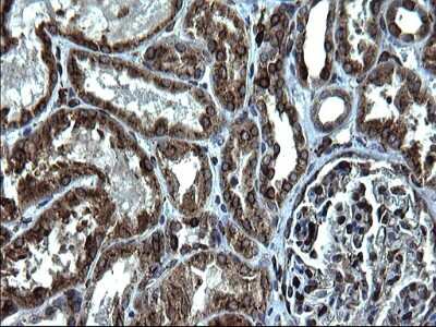 Immunohistochemistry: CD74 Antibody (OTI1H3) [NBP2-46179]