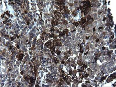 Immunohistochemistry: CD74 Antibody (OTI1H3) [NBP2-46179]