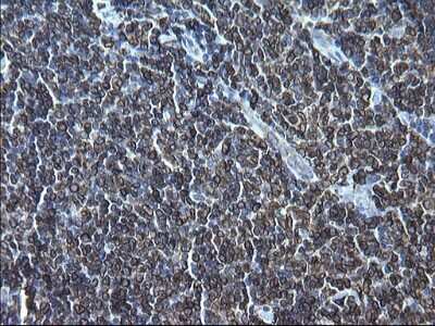 Immunohistochemistry: CD74 Antibody (OTI1H3) [NBP2-46179]