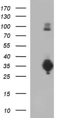 Western Blot: CD74 Antibody (OTI1H3) [NBP2-46179]