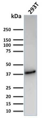 Western Blot: CD74 Antibody (CLIP/3127R)Azide and BSA Free [NBP3-08927]