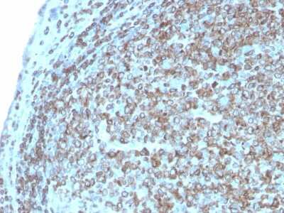 Immunohistochemistry-Paraffin: CD74 Antibody (CLIP/3127R) [NBP3-07225]