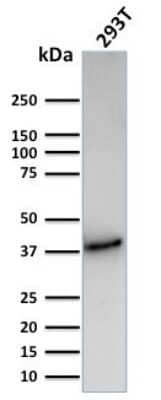 Western Blot: CD74 Antibody (CLIP/3127R) [NBP3-07225]