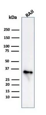 Western Blot: CD74 Antibody (CLIP/813)Azide and BSA Free [NBP3-11568]