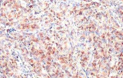 Immunohistochemistry-Paraffin: CD74 Antibody [NBP1-33109]
