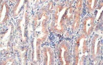 Immunohistochemistry-Paraffin: CD74 Antibody [NBP1-33109]