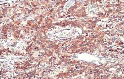 Immunohistochemistry-Paraffin: CD74 Antibody [NBP1-33109]