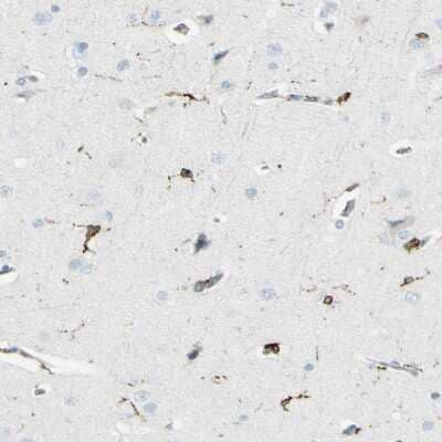Immunohistochemistry-Paraffin: CD74 Antibody [NBP1-85225]