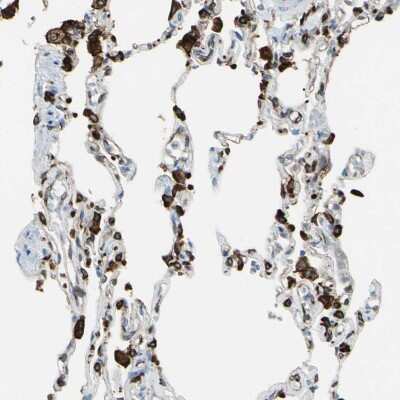 Immunohistochemistry-Paraffin: CD74 Antibody [NBP1-85225]