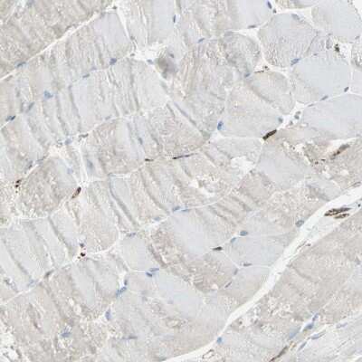 Immunohistochemistry-Paraffin: CD74 Antibody [NBP1-85225]