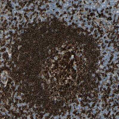Immunohistochemistry-Paraffin: CD74 Antibody [NBP1-85225]