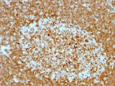 Immunohistochemistry-Paraffin: CD74 Antibody (LN-2 + CLIP/813) - IHC-Prediluted [NBP2-48027]