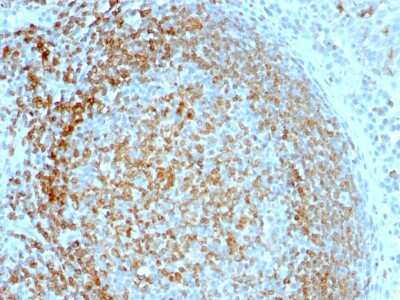 Immunohistochemistry-Paraffin: CD74 Antibody (LN-2) - Azide and BSA Free [NBP2-33088]