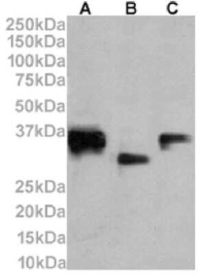 Western Blot: CD74 Antibody (LN-2)ChimericAzide and BSA Free [NBP3-12079]