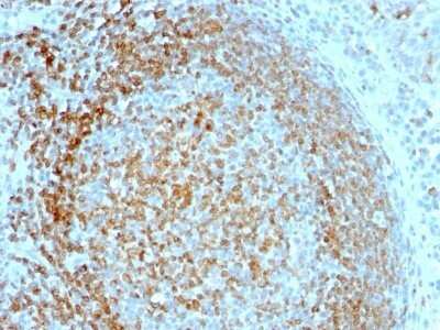 Immunohistochemistry-Paraffin: CD74 Antibody (LN-2) - IHC-Prediluted [NBP2-44988]