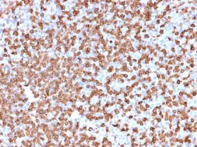 Immunohistochemistry-Paraffin: CD74 Antibody (LN-2) [NBP2-29465]