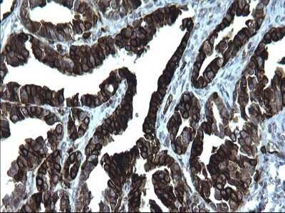 Immunohistochemistry: CD74 Antibody (OTI1H3) - Azide and BSA Free [NBP2-70382]