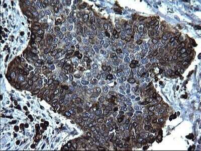 Immunohistochemistry: CD74 Antibody (OTI1H3) - Azide and BSA Free [NBP2-70382]