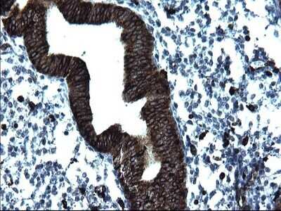 Immunohistochemistry: CD74 Antibody (OTI1H3) - Azide and BSA Free [NBP2-70382]