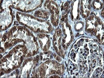 Immunohistochemistry: CD74 Antibody (OTI1H3) - Azide and BSA Free [NBP2-70382]