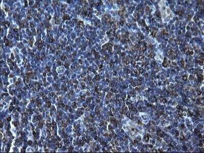 Immunohistochemistry: CD74 Antibody (OTI1H3) - Azide and BSA Free [NBP2-70382]
