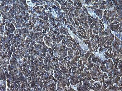 Immunohistochemistry: CD74 Antibody (OTI1H3) - Azide and BSA Free [NBP2-70382]