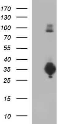 Western Blot: CD74 Antibody (OTI1H3)Azide and BSA Free [NBP2-70382]