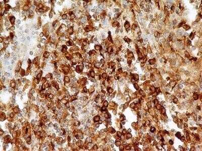 Immunocytochemistry: CD74 Antibody (PIN.1) - Azide and BSA Free [NBP2-80657]