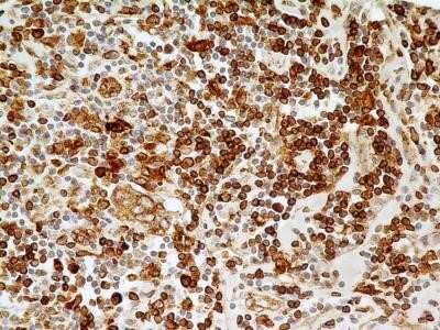 Immunohistochemistry: CD74 Antibody (PIN.1) - Azide and BSA Free [NBP2-80657]