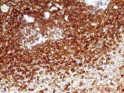 Immunohistochemistry-Paraffin: CD74 Antibody (PIN.1) - Azide and BSA Free [NBP2-80657]