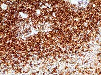 Immunohistochemistry-Paraffin: CD74 Antibody (PIN.1) - BSA Free [NB100-1985]