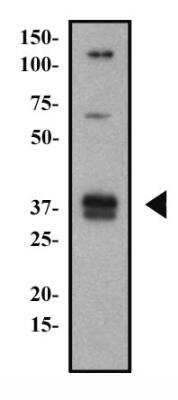 Western Blot: CD74 Antibody (PIN.1)BSA Free [NB100-1985]