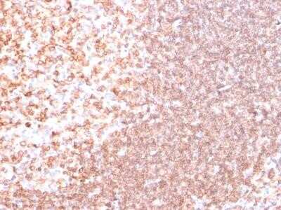 Immunohistochemistry-Paraffin: CD74 Antibody (SPM523) - Azide and BSA Free [NBP2-34778]