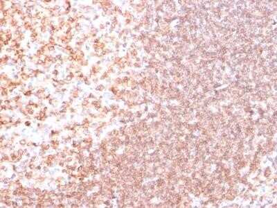 Immunohistochemistry-Paraffin: CD74 Antibody (SPM523) - IHC-Prediluted [NBP2-44989]