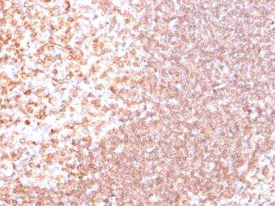 Immunohistochemistry-Paraffin: CD74 Antibody (SPM523) [NBP2-32947]