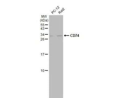 Western Blot: CD74 Antibody [NBP1-33109]