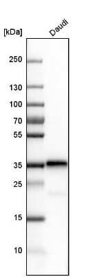 Western Blot: CD74 Antibody [NBP1-85225]