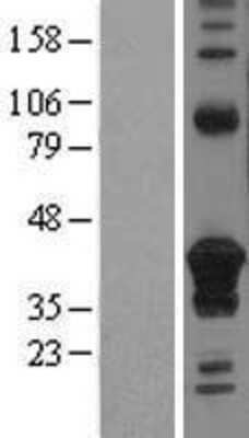 Western Blot: CD74 Overexpression Lysate [NBL1-08968]