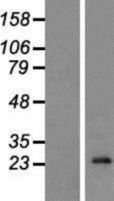 Western Blot: CD74 Overexpression Lysate [NBP2-09801]