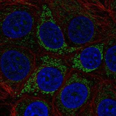 Immunocytochemistry/ Immunofluorescence: CD77 Synthase Antibody [NBP1-90824]