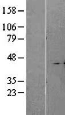 Western Blot: CD77 Synthase Overexpression Lysate [NBL1-07158]