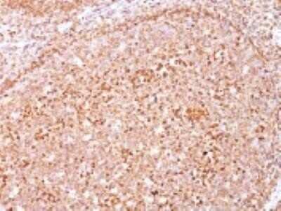 Immunohistochemistry-Paraffin: CD79A Antibody (HM47/A9) - IHC-Prediluted [NBP2-48028]